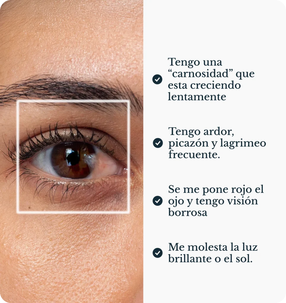 carnosidad en el ojo con enrojecimiento y crecimiento de tejido en la superficie ocular