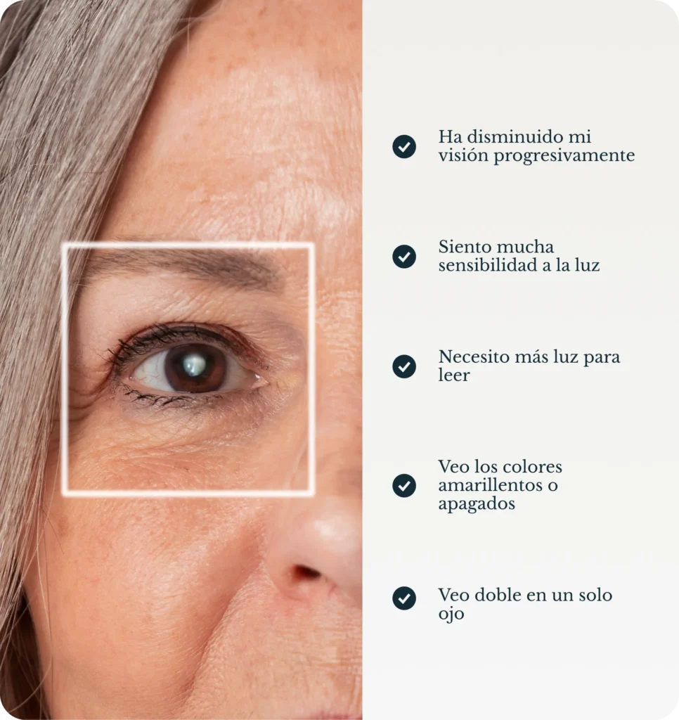 Síntomas de la catarata en el ojo: visión borrosa, sensibilidad a la luz y cambios en los colores