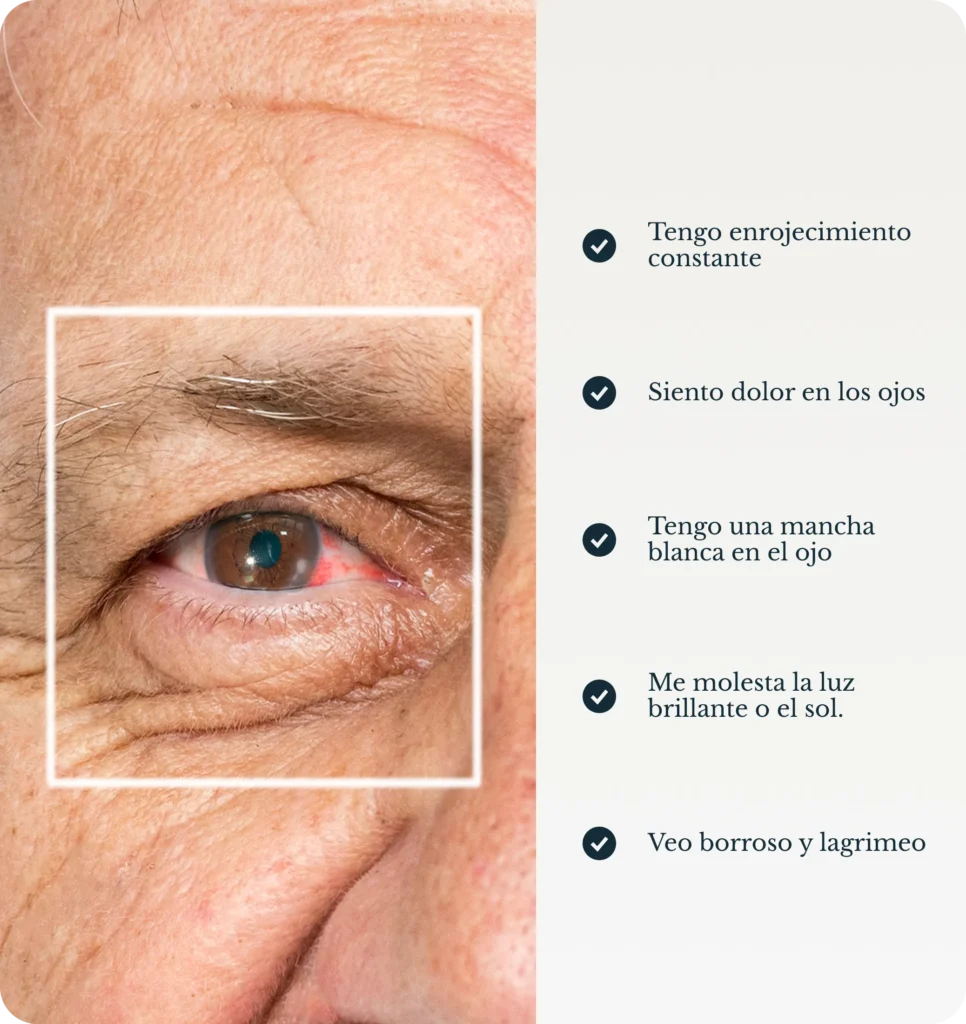 Leucoma en el ojo: mancha blanca en la córnea que afecta la visión