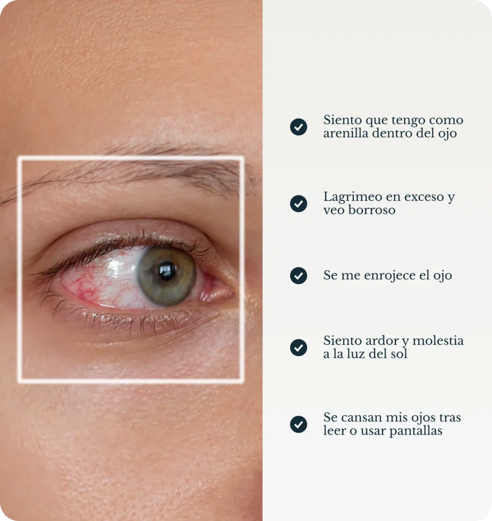 Ojo seco: irritación ocular, ardor y sensación de arenilla en los ojos