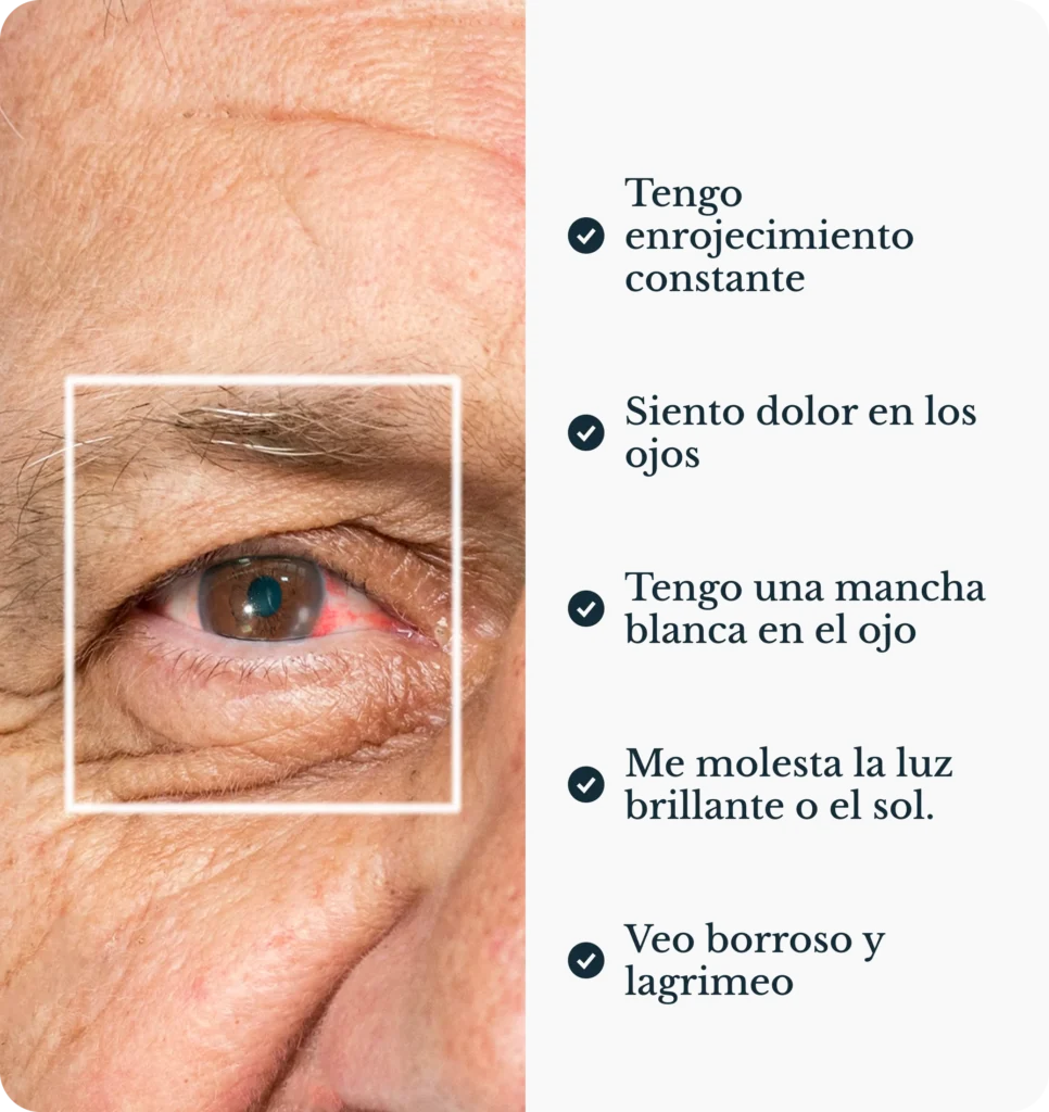 Leucoma en la córnea: opacidad blanquecina que causa disminución de la visión