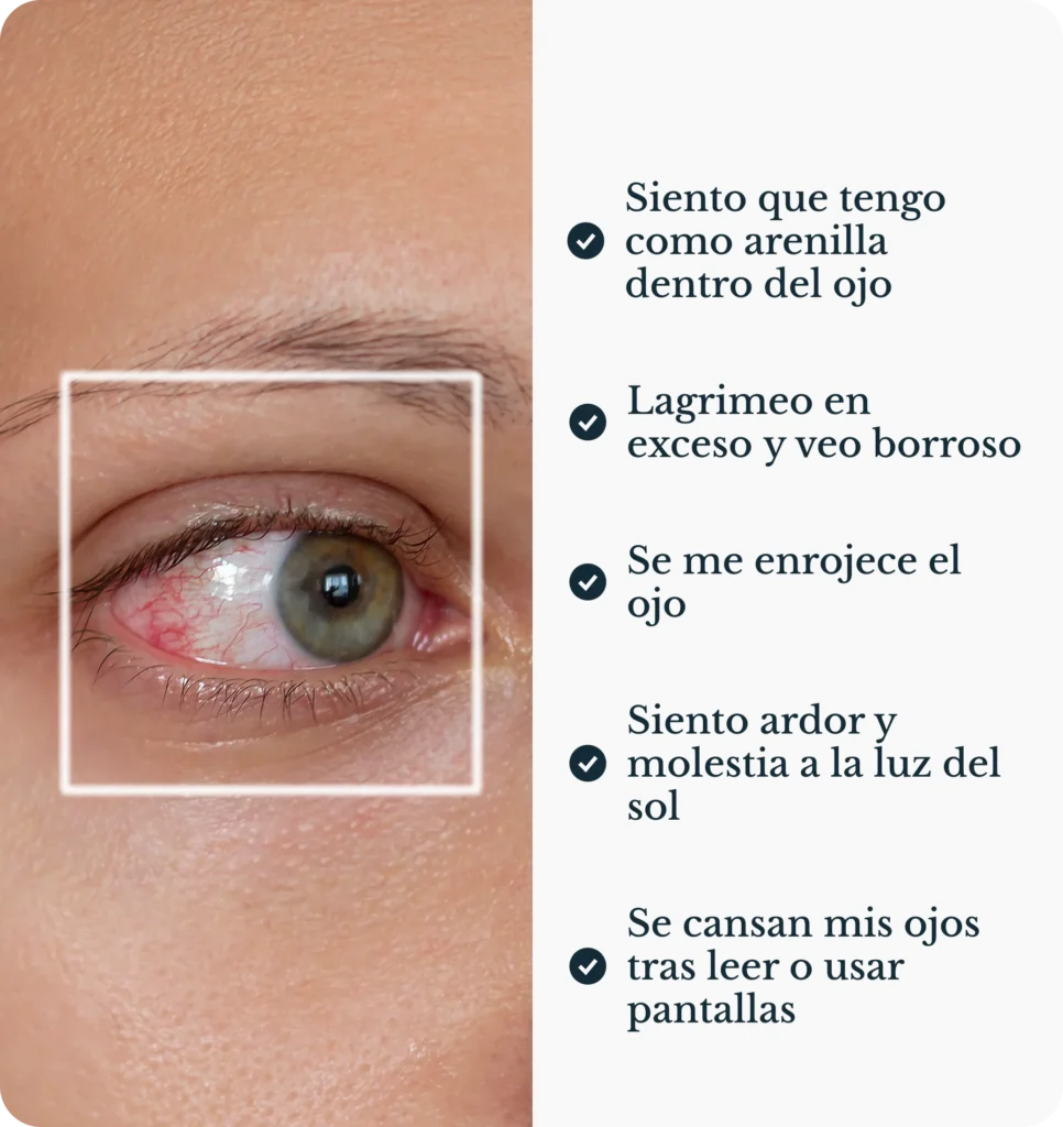 Síntomas del ojo seco: enrojecimiento, ardor y sensación de cuerpo extraño en el ojo